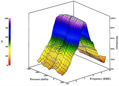 The Role of Wideband Tympanometry in the Diagnosis of Meniere's Disease